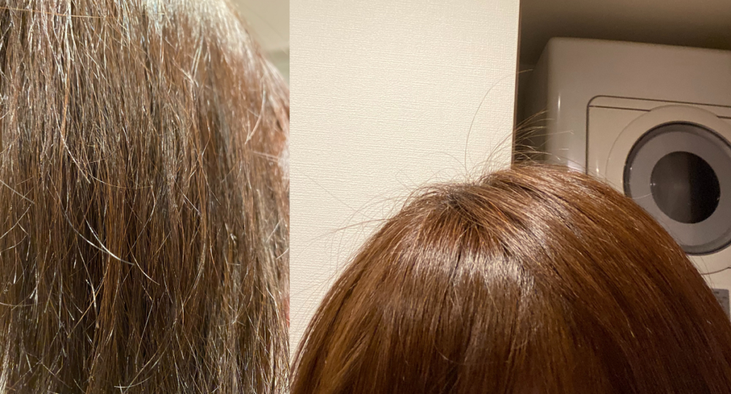 左が１ヵ月後のビビリ毛の状態の写真で右が頭頂部付近のツヤツヤの髪